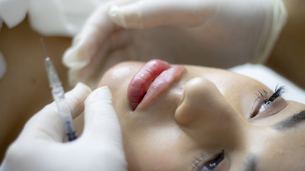 Close-up of a woman receiving a lip augmentation with a syringe by a professional.